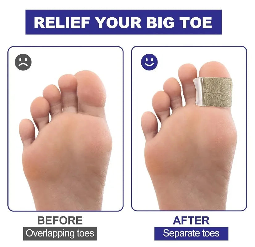 2PC Gel Toe Spacers Bunion Corrector with Loops Portable Toe Separators for Bunion Overlap Toe Hammer Toe Big Toe Alignment