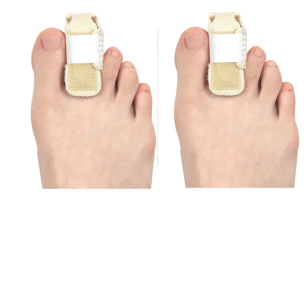 1/2/3/4Pcs Toe Splint Toes Straightener for Hammer Toe Corrector for Women Toe Brace Hammertoe Splint Toe Wrap Toe Covers Broken